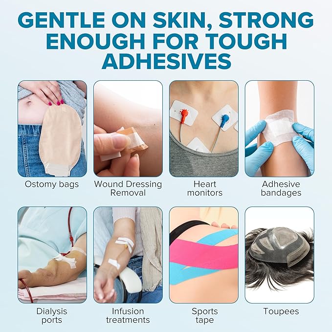 Ultimate Medical Adhesive Remover Spray – Silicone-Based, No-Sting & Odorless – Quick-Drying Bandage Adhesive Remover for Skin – Gentle, Low-Residue Formula for Sensitive Skin & Ostomy Care - 80 ml