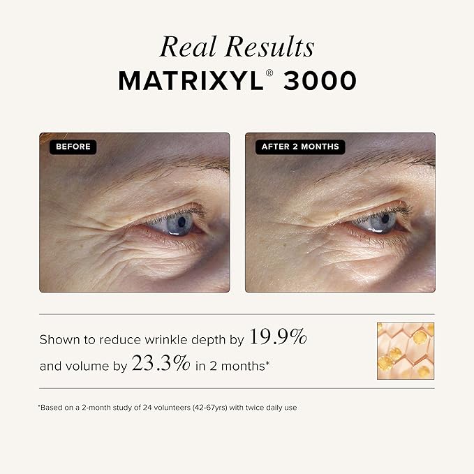 Asterwood Matrixyl 3000 + Argireline Serum for Face - Multi Peptide Serum with Hyaluronic Acid - Anti-Aging, Wrinkle Reducing, Collagen Boosting - Fragrance-Free - 1 Fl Oz