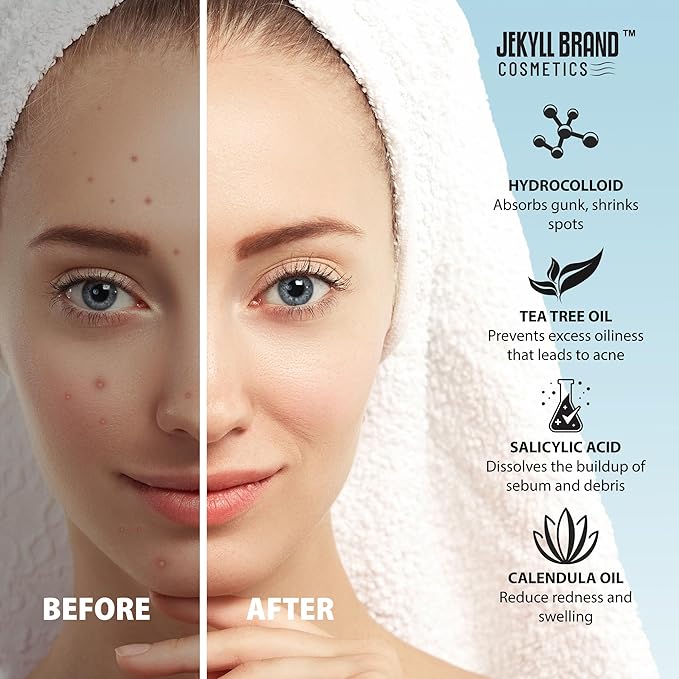 Jekyll brand Pimple Patch for Cheeks (12 counts) COSMETICS™ | Medical Grade Hydrocolloid | Acne Patch for Covering Zits and Blemish | Cheeks Patches for Acne | **Dermatologist Approve**