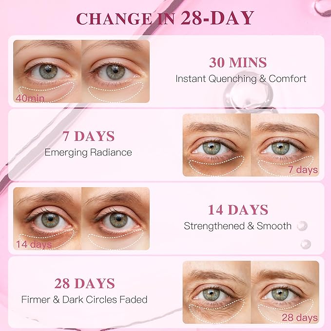 Collagen Under Eye Patches for Puffy Eyes and Dark Circles, Under Eye Mask for Wrinkle with Ginseng, Deep Hydrating Undereye Mask Patches, Christmas Small Gifts for Women (12 Pairs, Ginseng)