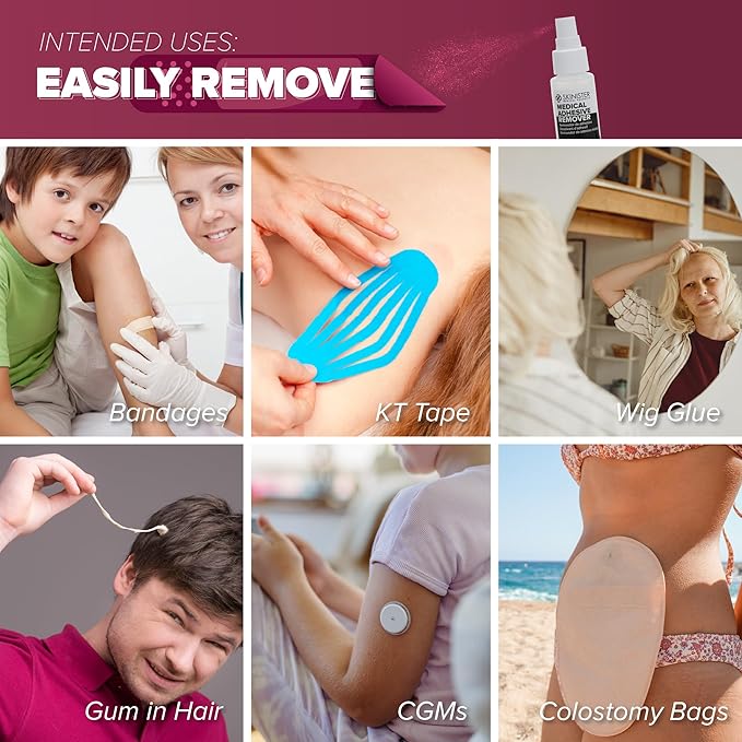 Medical Adhesive Remover for Skin | Wig, Ostomy, Tape, and Bandage Adhesive Remover | Silicone-Based, Hypoallergenic, Sting-Free | 2oz Spray