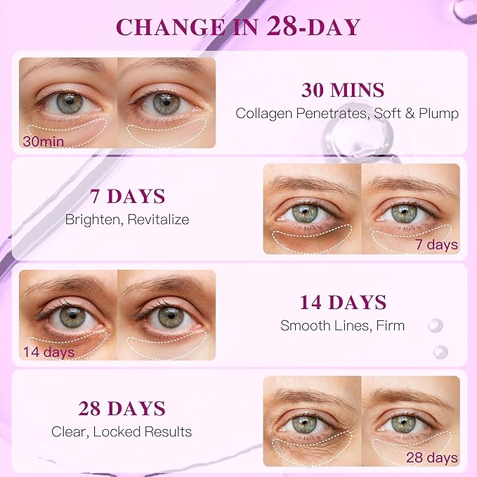 ICIKOL Collagen Under Eye Patches for Puffy Eyes and Dark Circles, Overnight Under Eye Mask for Puffiness, Deep Hydrating Undereye Mask Patches for Treatment (60 Pairs, Pearl powder)