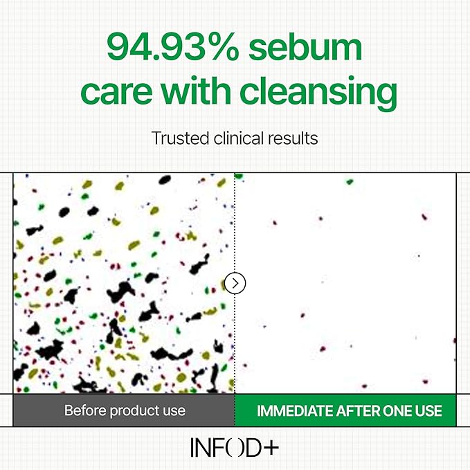 INFODPLUS XCESPI316 Gel Cleanser – Exosome & Walnut Powder | Foaming Korean Face Wash for Deep Pore Cleansing, Blackhead Care & Hydration
