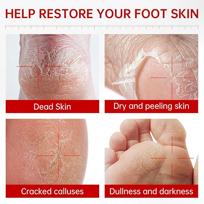 QQE 3 Pack Foot Peeling Mask, Hydrating Exfoliating Foot Mask for Dry Cracked Feet, Callus Remover & Cracked Heel Repair & Foot Care