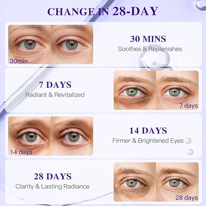 Collagen Under Eye Patches for Puffy Eyes and Dark Circles, Under Eye Mask for Radiance Boost, Deep Hydrating Undereye Mask Patches for Treatment with Women Beauty (12 Pairs, Grape seed)