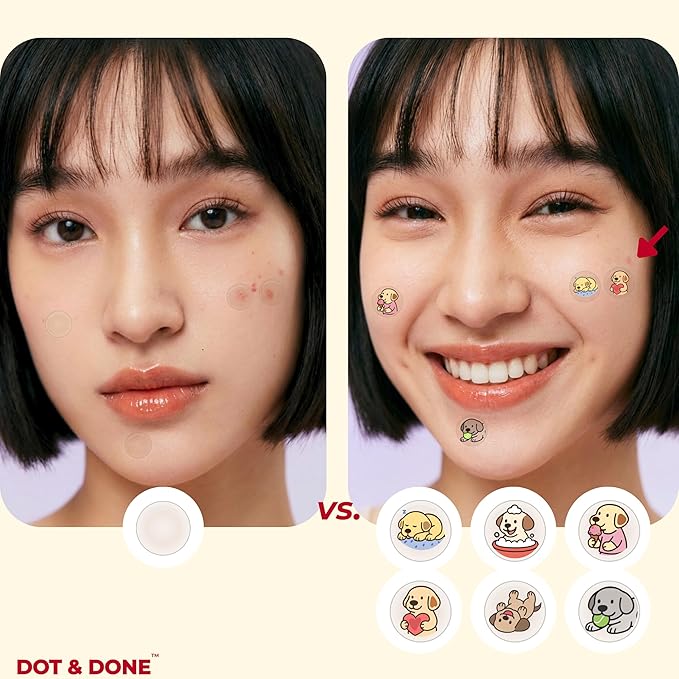 DOT & DONE Hydrocolloid Pimple Patches for Face, 48 Count 12 mm Round Acne Spot Dots with 6 Cute Dog Designs, Cute Pimple Patches for Teens & Adults, Day & Night Use, Buddy Dot Series