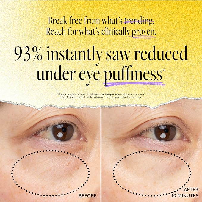 Derma E Vitamin C Bright Eyes Hydro Gel Under Eye Patches for Dark Circles (60 Ct, 30 Pairs) Allantoin, Caffeine & Vitamin B3, Eye Patches for Fine Lines, Wrinkles, Dark Circles & Puffy Eyes