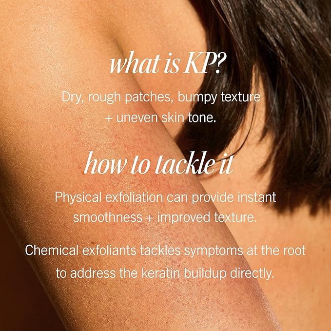 First Aid Beauty - KP Bump Eraser Body Scrub with 10% AHA, Keratosis Pilaris Skin Exfoliater with Glycolic and Lactic acids, Helps Reduce Chicken Skin Bumps, Safe for Sensitive Skin, 8 oz + Bonus, 2ct
